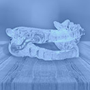 Sleep apnea appliance blue highlight