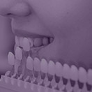 Smile compared with color shade chart