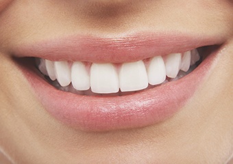 Closeup of healthy smile