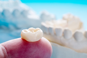 A dental crown on a fingertip