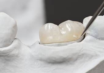 Model tooth with dental crown