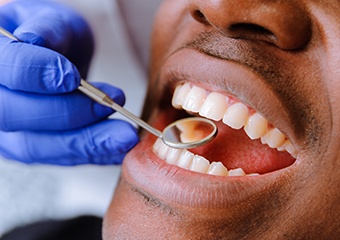 Closeup of patient receiving dental care