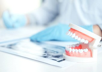 An up-close view of a mouth mold and a patient’s dental X-rays lying on a desk