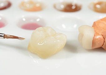 Dentla crown restoration