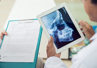 X-rays of jaw and skull