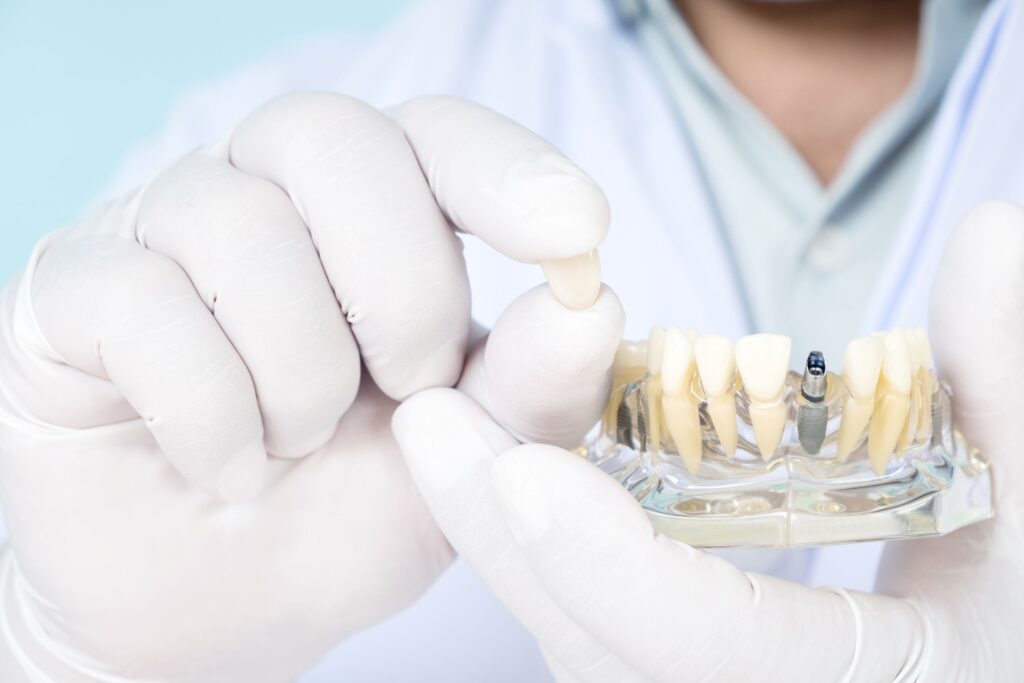 White-gloved hands holding sample jaw with dental implant in one hand and dental crown in the other